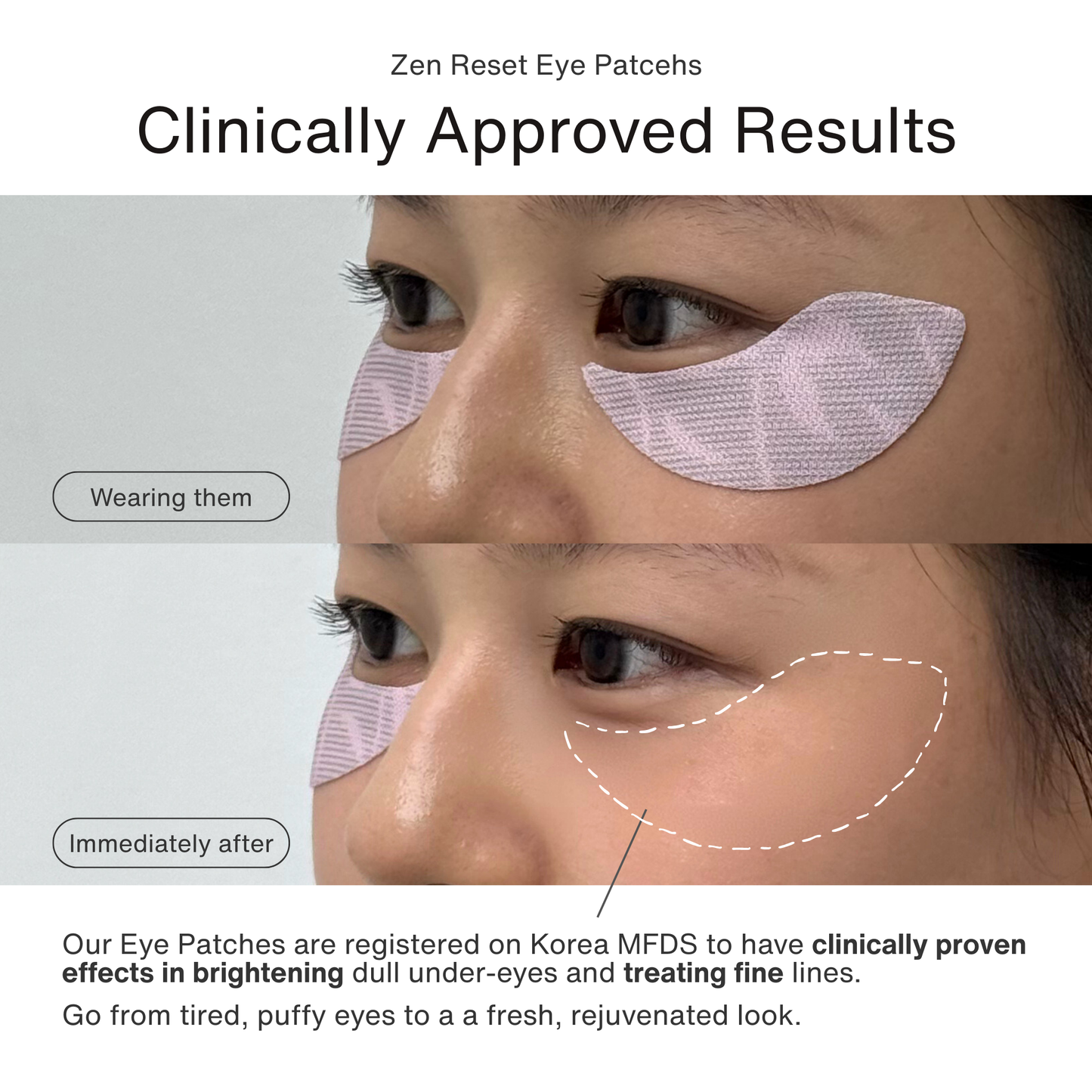 Zen Reset Eye Patches